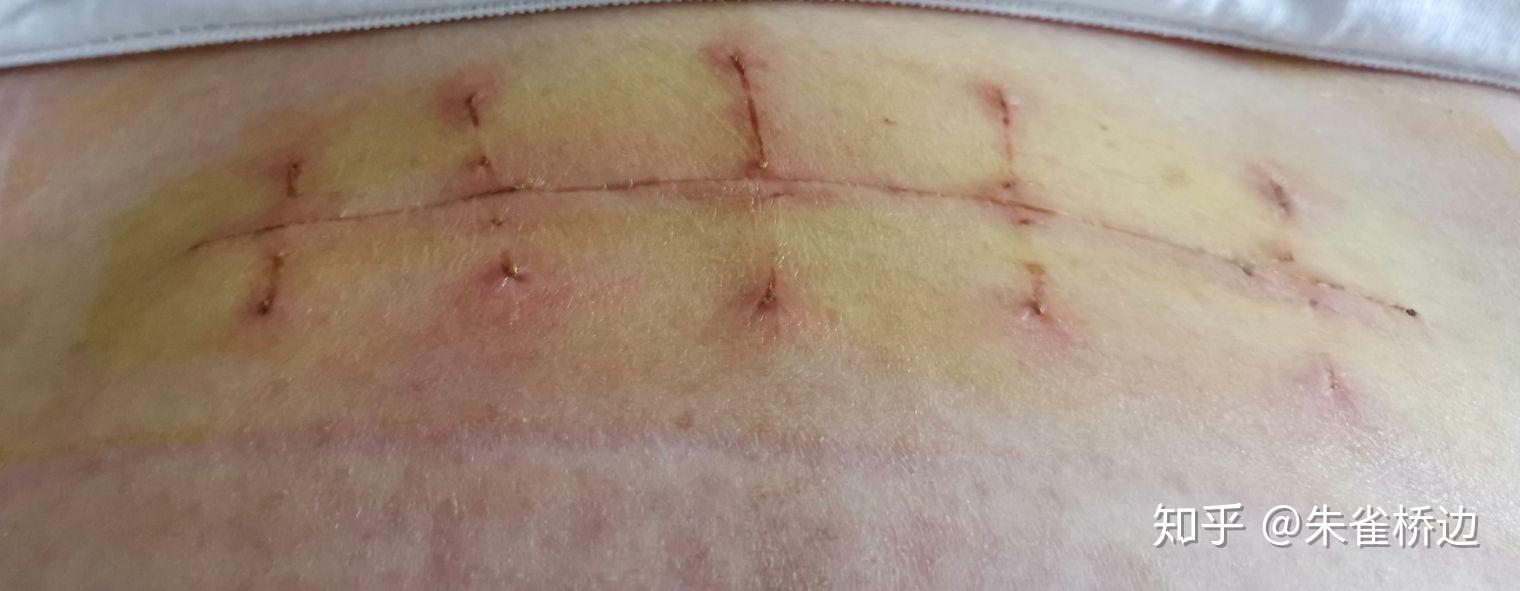 从下了手术台,麻药褪去的那一刻起,它在愈合过程中所有的疼痛与委屈