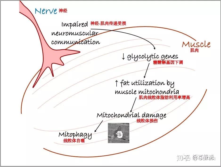 肯尼迪病专栏10:2017kda大会前沿进展(二)|肯尼迪病人机体代谢变化