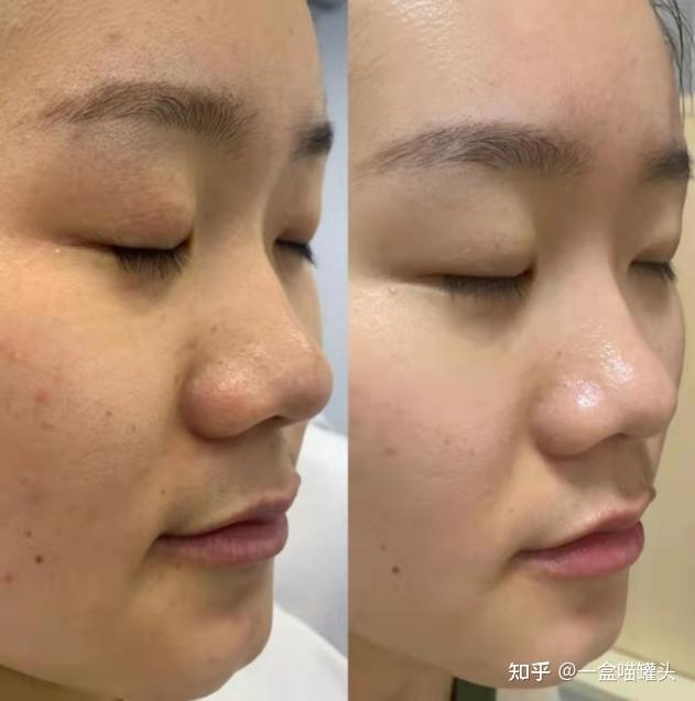 有什么好喝不贵能改善皮肤状态的饮品肤色暗沉喝什么