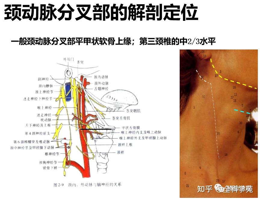 汤氏位是眉弓与枕外隆凸重叠的位置,大约为20度~30度点击图片可查看