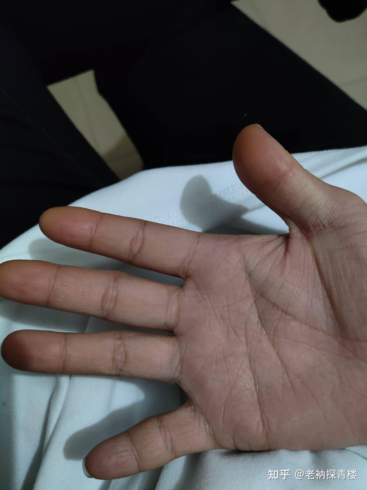 手指头又短太粗救救我