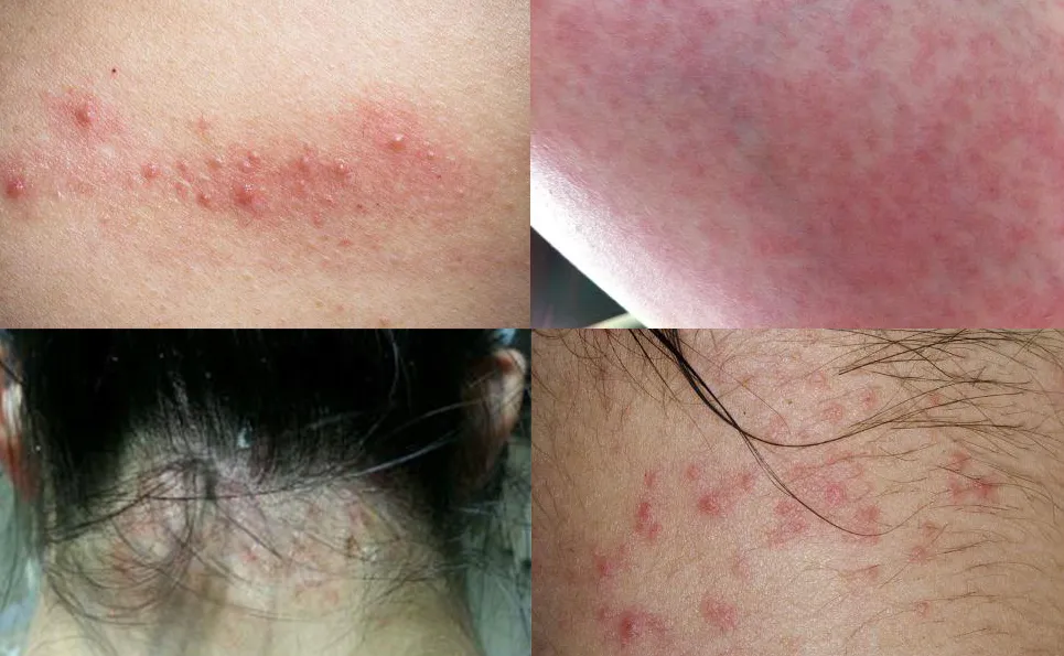 限时抢购五星级希尔顿总统套房的枕头睡起来是什么感觉