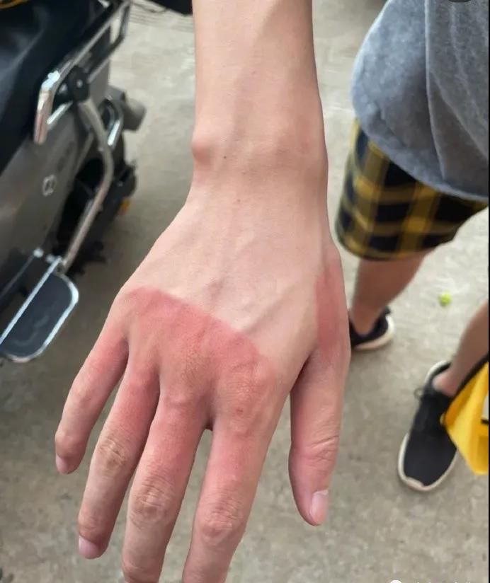 人类确实是一种聪明的生物为了防止手臂晒黑发明了冰袖哈哈哈哈