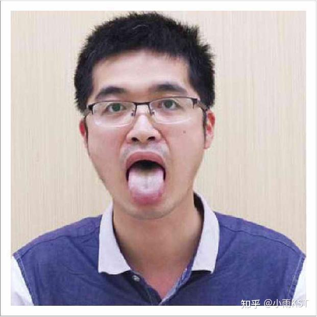 看舌头的内容与方法