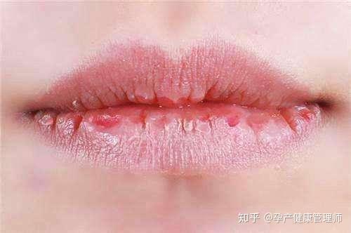 一唇看出你的身体状态 中医教你从唇色 读 健康 知乎