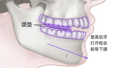 v2-dfefe6c35132c0eeaa0add58652bf081_b.jpg