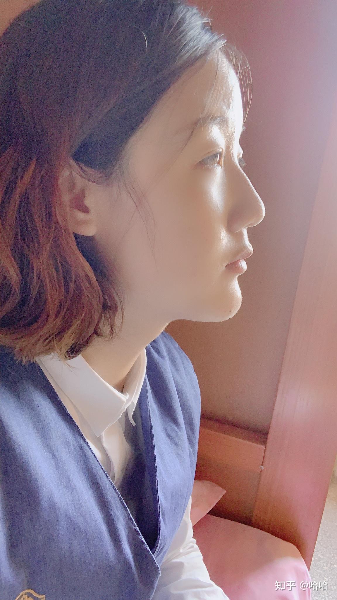 侧颜不好看 - 知乎