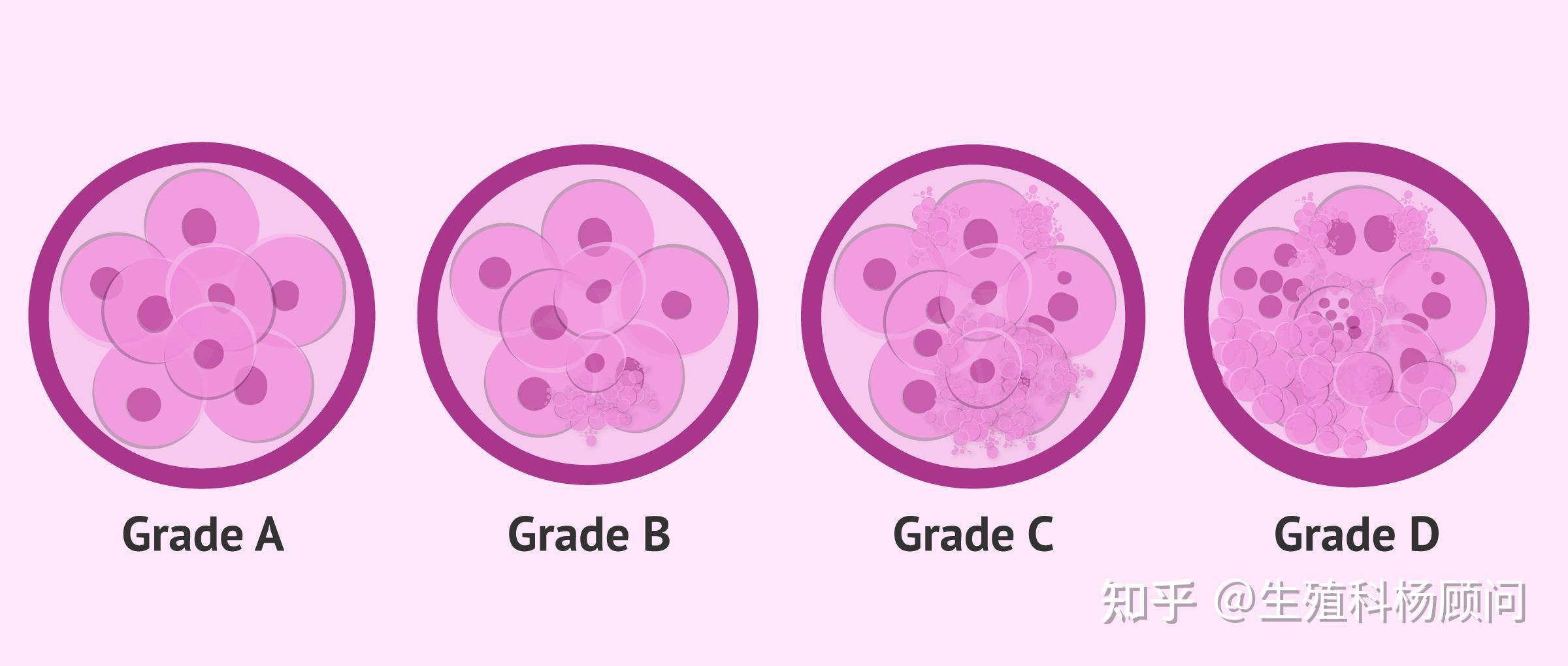 卵裂球折光性一般,大小不太均匀,碎片 20%;c级(3级):细胞团的大小和