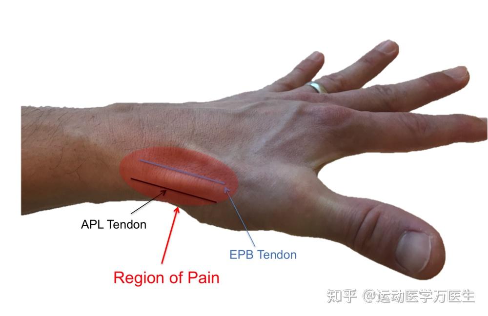 手機玩多了手腕疼小心媽媽手找上你