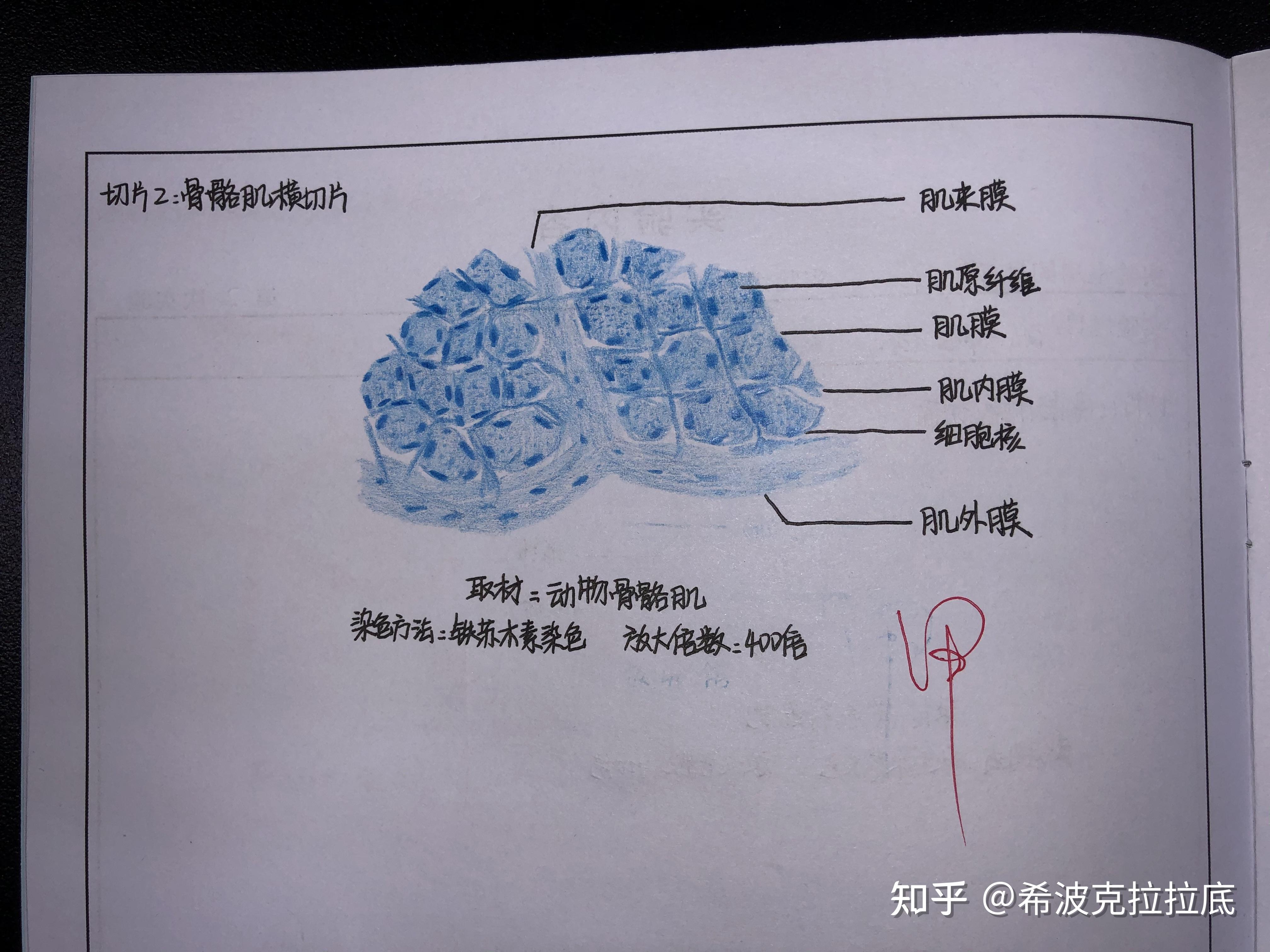 骨骼肌手绘图40×10倍图片