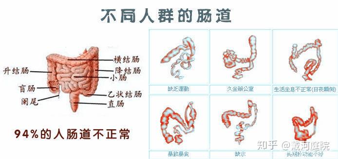 肠道水疗spa净排对宿便和便秘等的养生调理作用