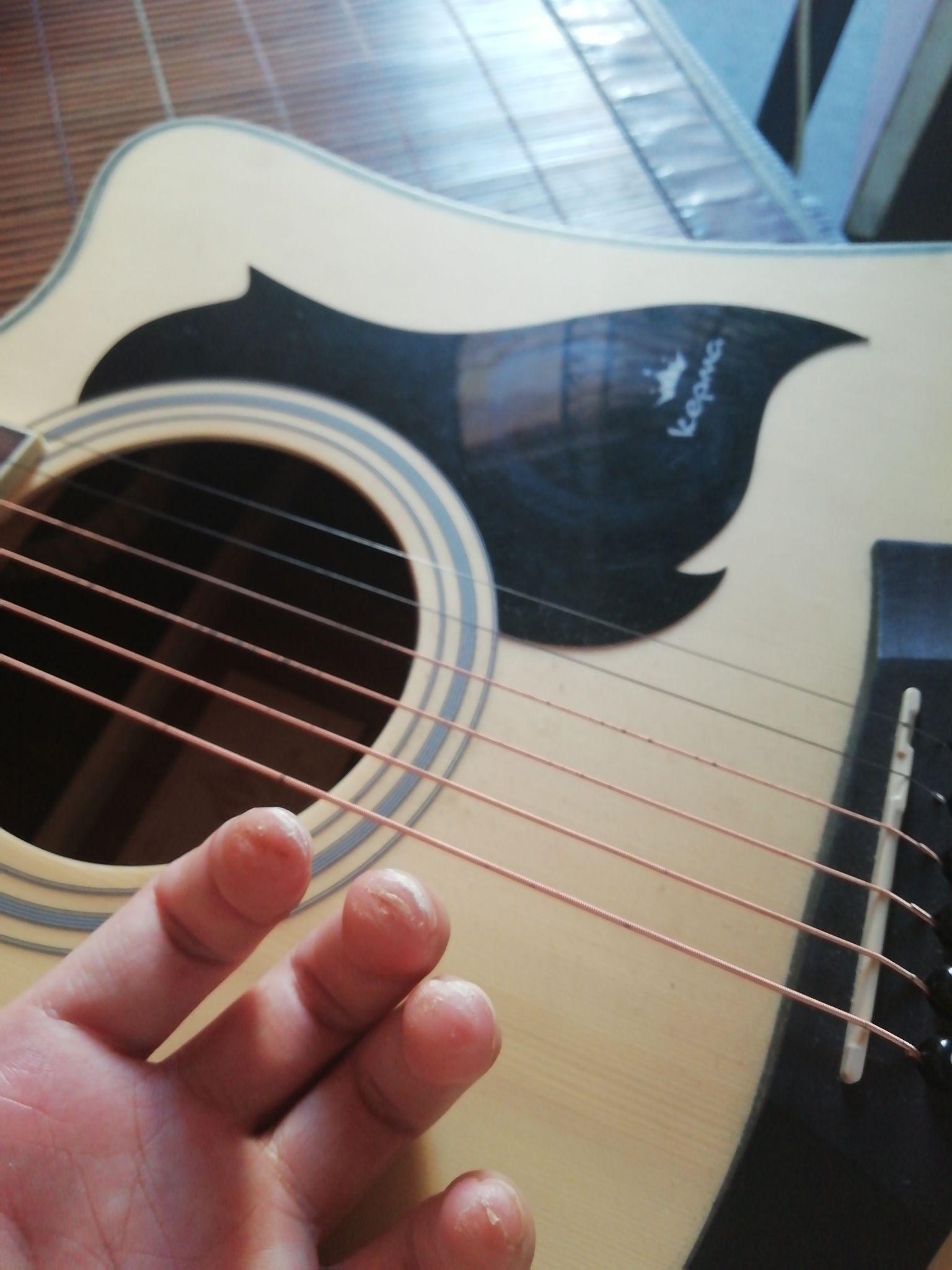 大家弹吉他的手指都是什么样的