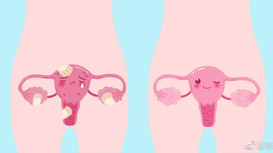 为什么中国女人年纪轻轻就"卵巢早衰"了?