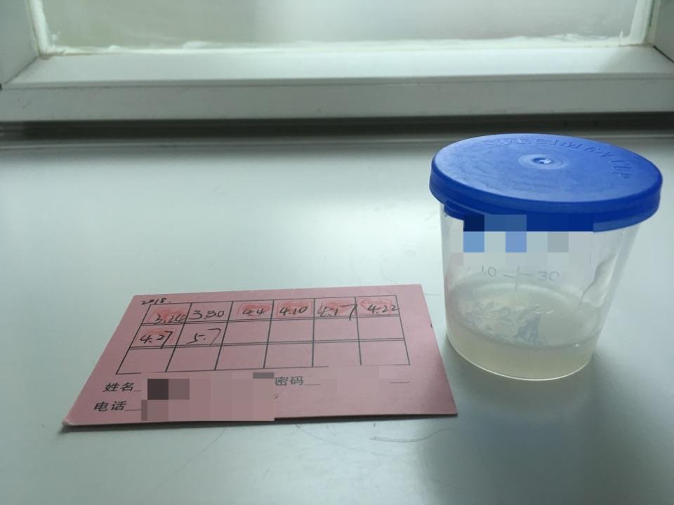 捐精是一种怎样的体验?