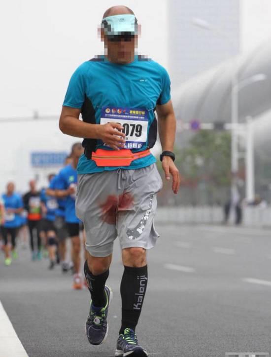 鸡儿疼! 合肥马拉松一男子私处流血染红运动裤