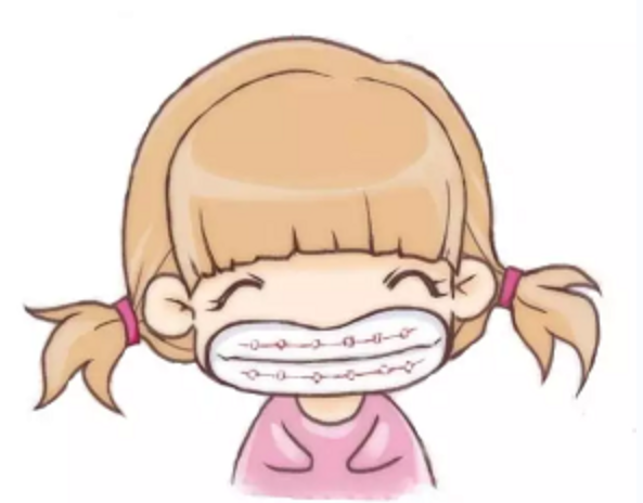 广州牙齿矫正正畸哪家医院口碑好价格适中技术好审美好价格实惠的医生