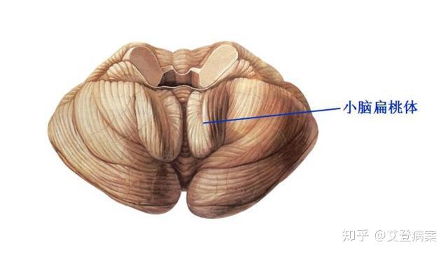 小脑两侧膨大部为小脑半球,中间狭窄部为小脑蚓,在小脑半球下面的前