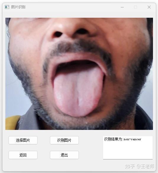 深度学习之基于Pytorch根据舌象图像舌头病变识别系统 - 知乎