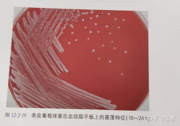 临床微生物学诊断与图解（第四版）上册 六、表皮葡萄球菌 185页 知乎 8017