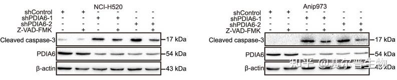 细胞自噬看这篇：发生机制/检测方法/研究思路！看完全明白！ - 知乎