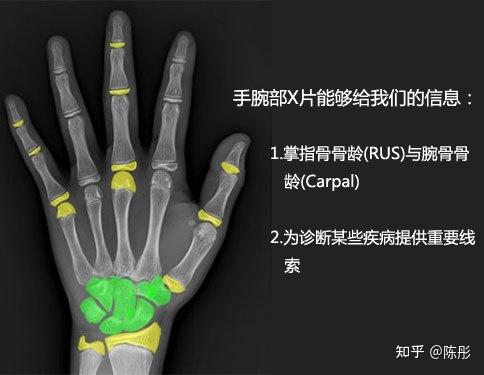 小米熊陳彤為什麼說骨齡決定身高