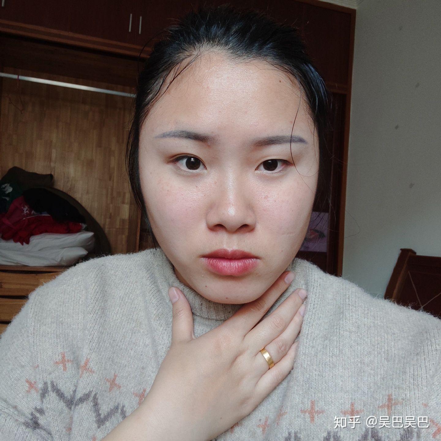 左右脸不对称怎么办?(带图)?