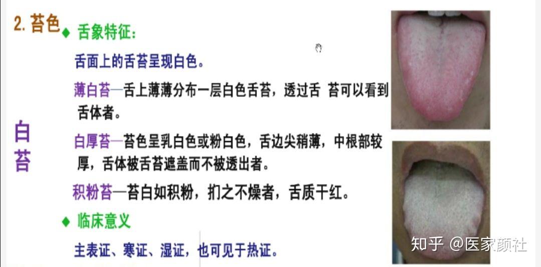 如何通过舌苔来判断身体健康与否?最全舌像来了,一分钟教你学会所有舌像! - 知乎