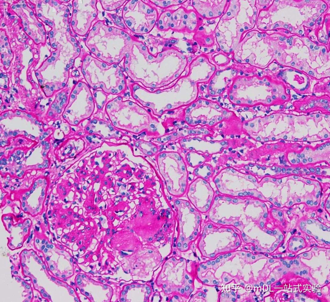 糖原染色法显微镜下的桃花源