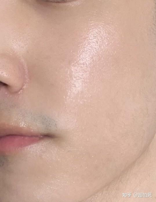 毛孔粗大痘痘黑头多大油脸怎么办4步解决皮肤问题3个月养成细腻肌肤