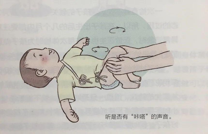 寶寶腿紋不對稱是怎麼回事兒