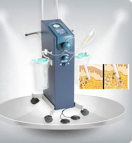 负压吸脂水动力吸脂bodytite射频吸脂光纤溶脂冷冻溶脂到底哪种好