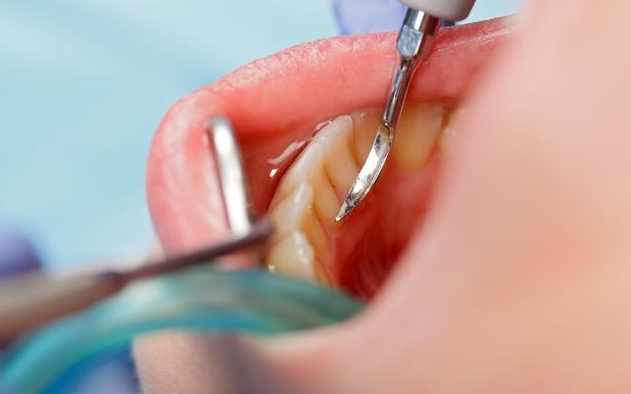 v2-e2a02d11e4657035d157b81ac90de24d_1440w.jpg?source=172ae18b