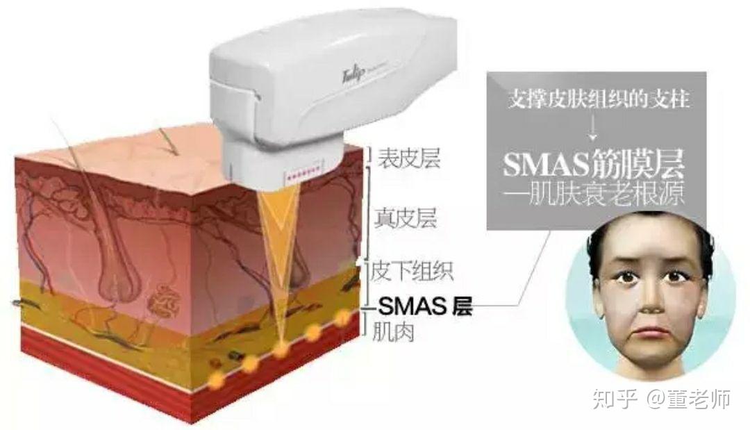 超声刀后变方脸一个多月了还有硬块