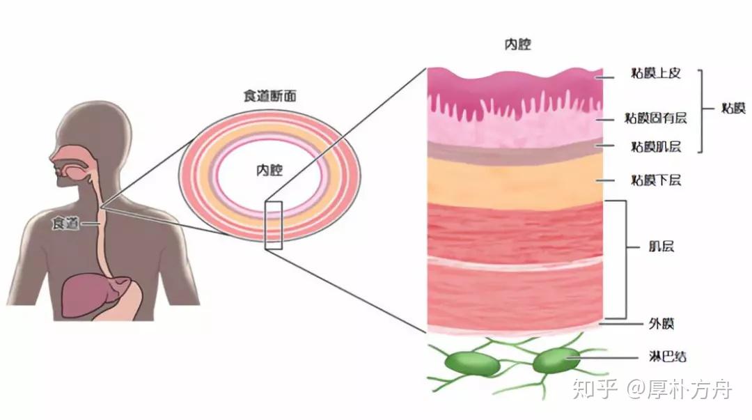 消化道肿瘤知名专家福永哲日本是如何治疗食管癌的