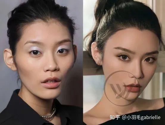 什么样的颞部最具美感？ - 知乎