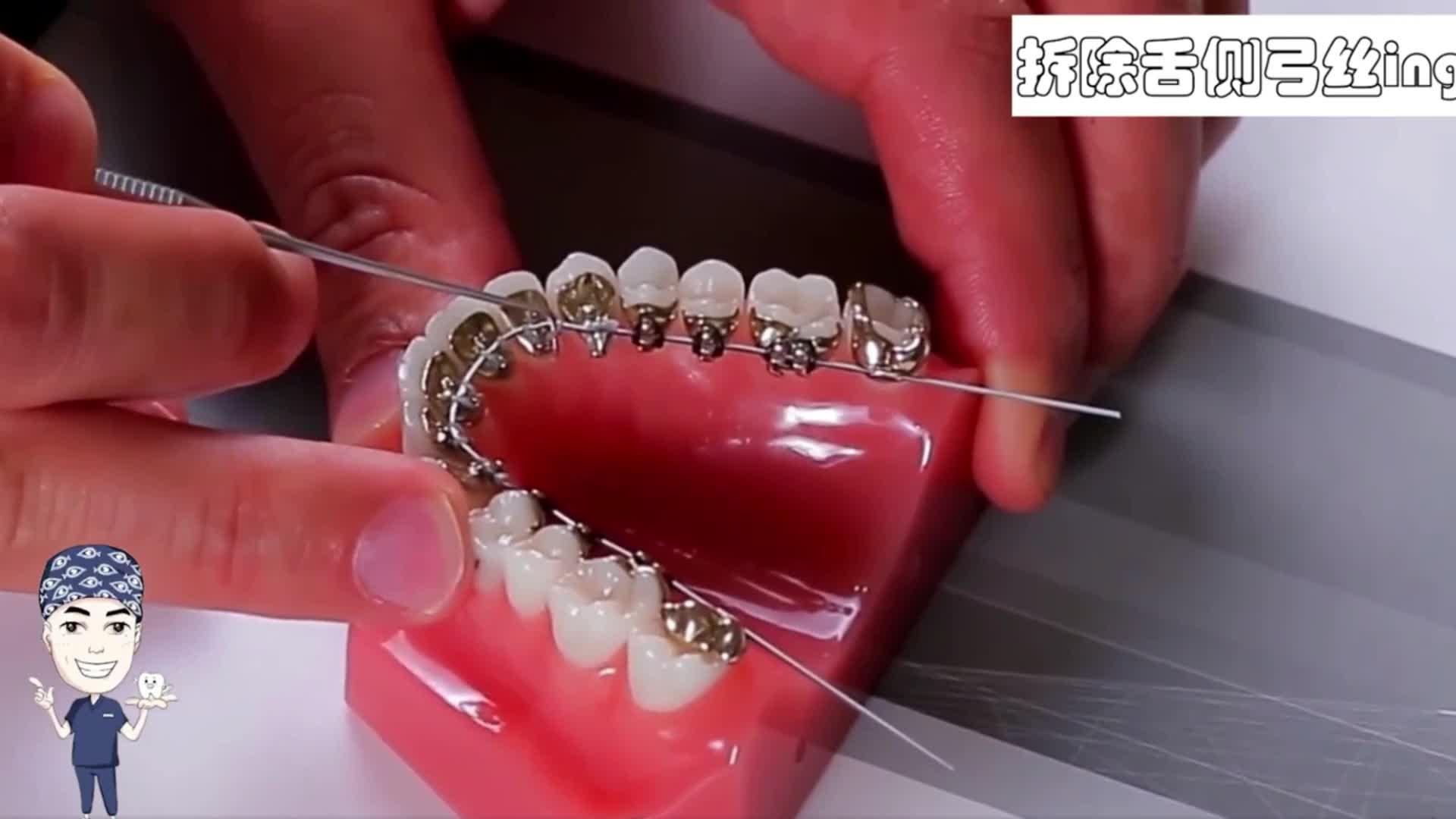 器是不是 发布于 17 小时前 · 13 次播放牙套隐形牙齿矫正牙齿正畸