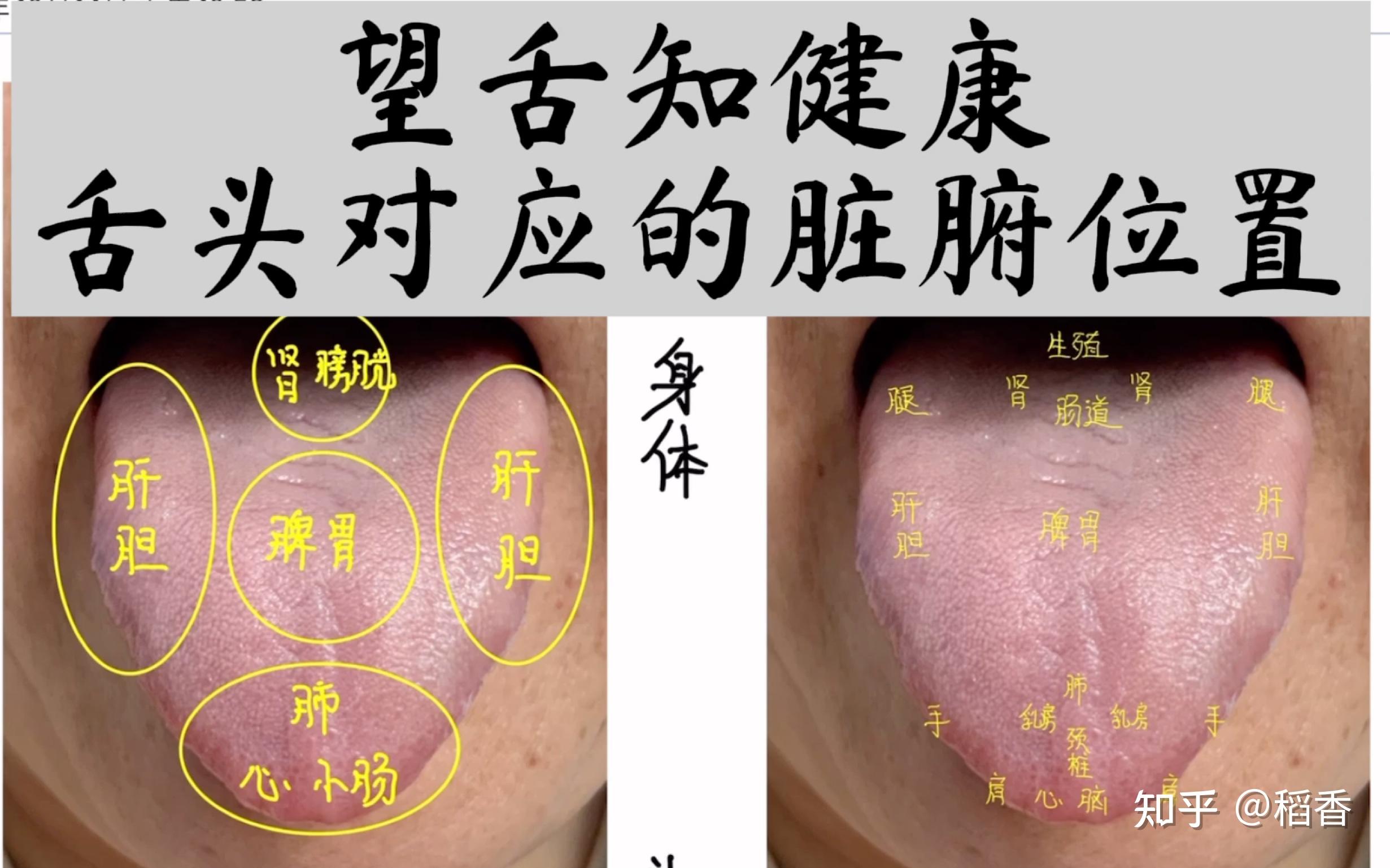中医舌诊心法秘诀 - 知乎