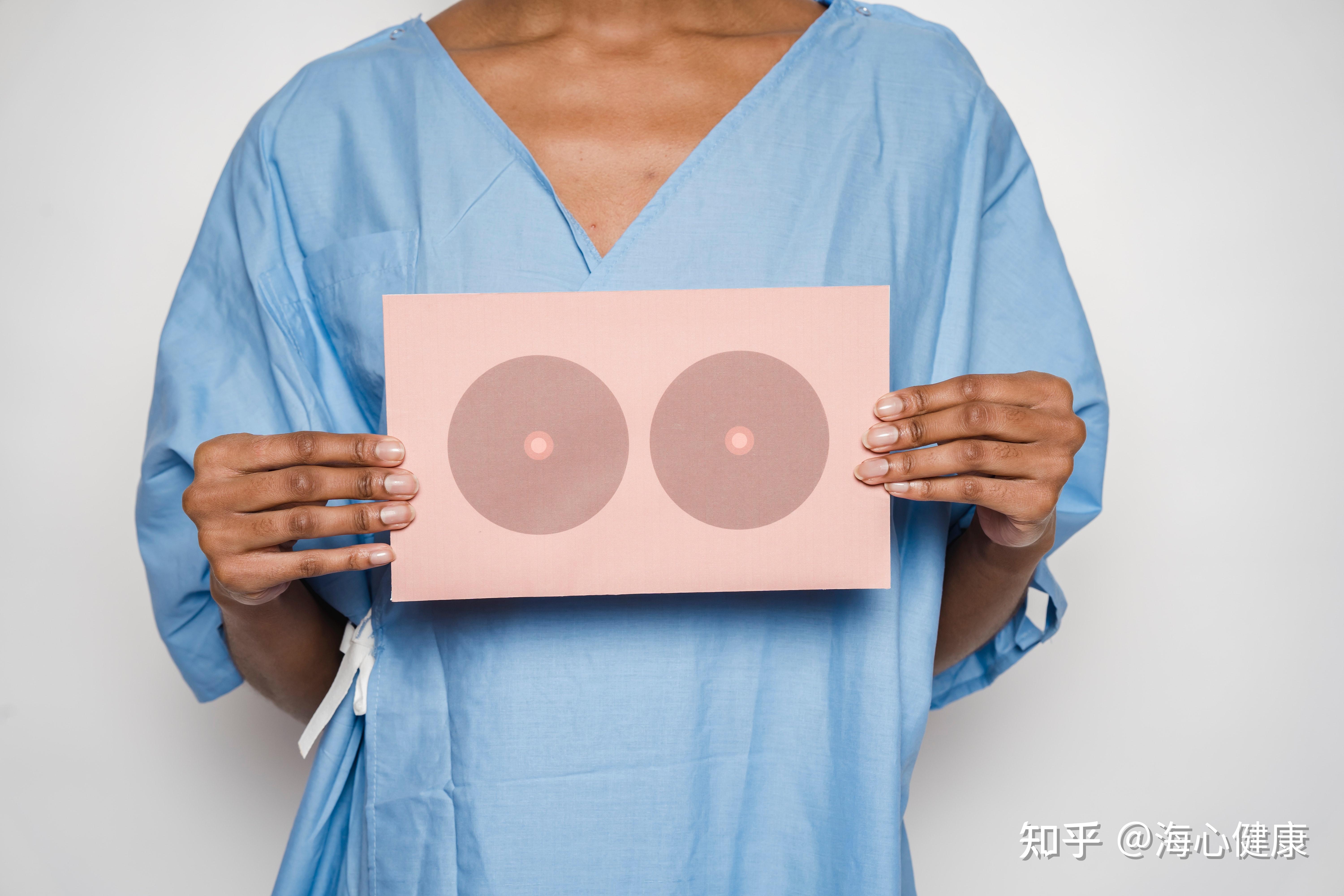 乳房重建材料大不同,乳腺癌患者该如何选择?