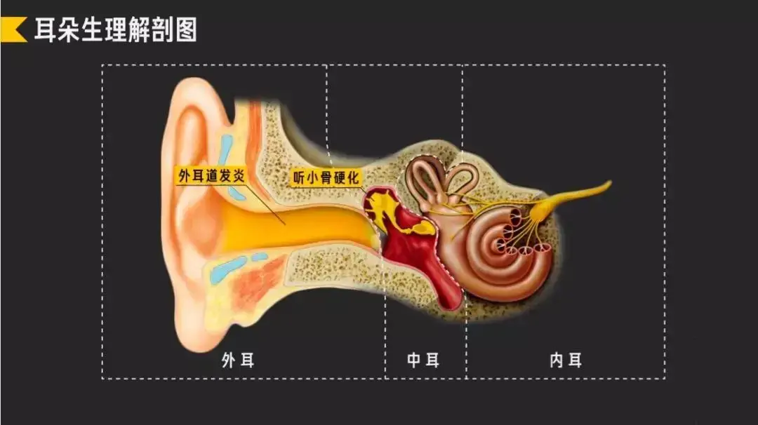 助听器是如何补偿听力的?