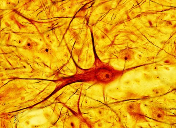 神经组织显微镜观察图图片