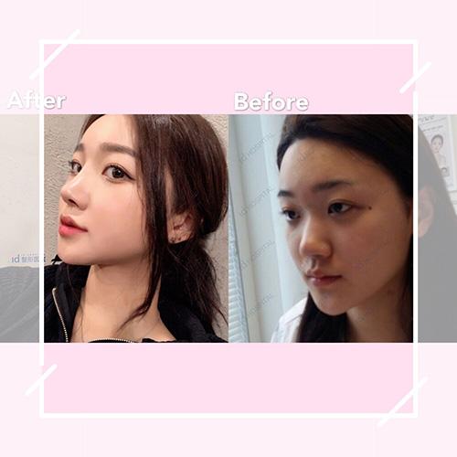 如何让脸变得更有立体感 v2-e3ad47b51bc33974053739b4a655d69a_1440w.jpg?source=172ae18b