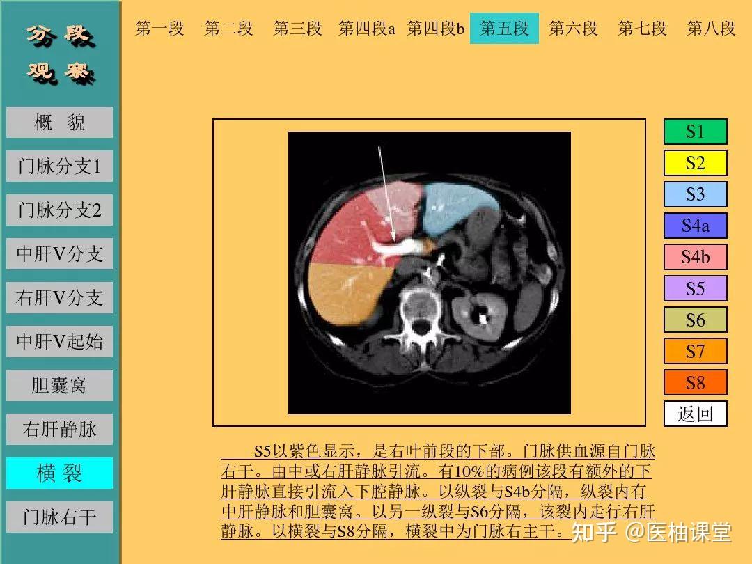 肝脏的CT断层解剖详解 - 知乎