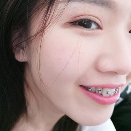 v2-e3cb7c6e9247c2d09b0e9e2a860b8bda_1440w.jpg?source=172ae18b