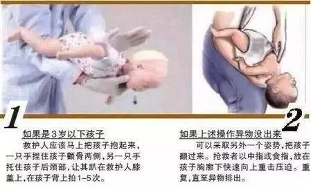 宝宝的急救课 一 之哈姆立克法 心肺复苏的正确操作方法 知乎