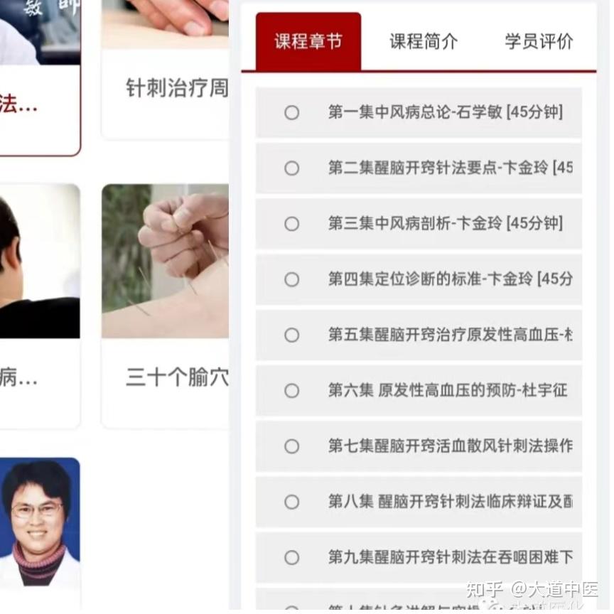 石学敏院士醒脑开窍针法 针灸处方 - 知乎