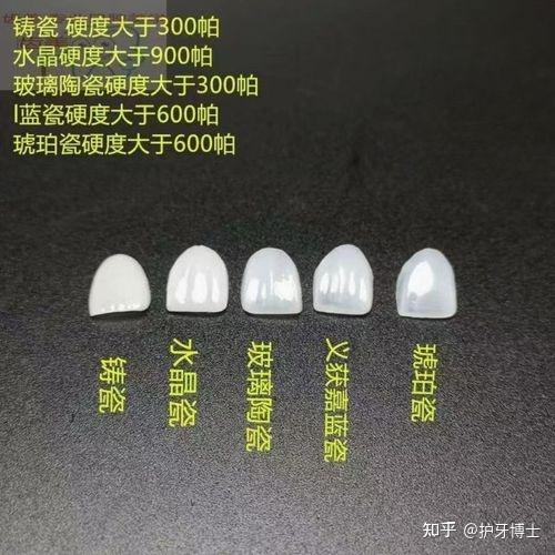 牙齿贴面专题牙贴面的种类应该怎么选价格大概是多少呢