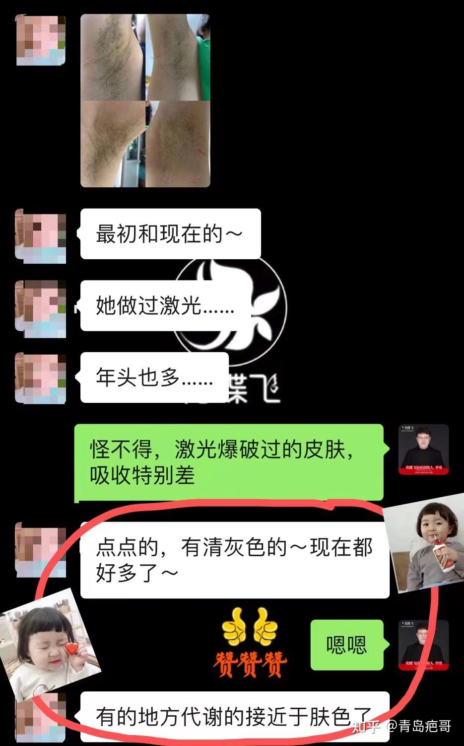 腋下手术疤痕真的不建议做激光 - 知乎