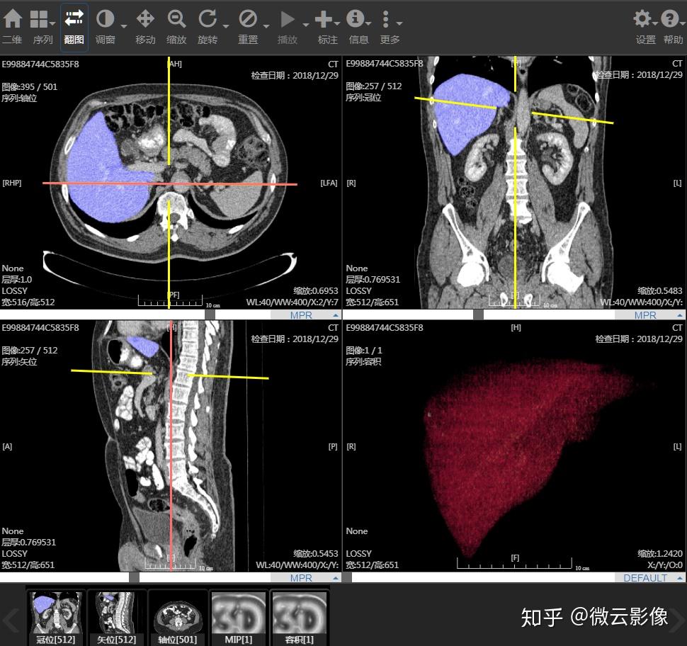 即时人工智能：重新定义客户体验，实现实时交互 (今天人工智能)