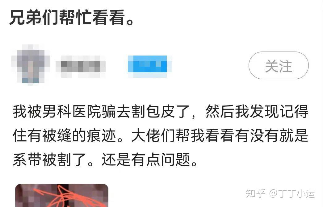 系带延长、系带切除、术后过度治疗...不良男科医院4种坑人手段,请丁友闭坑~ - 知乎