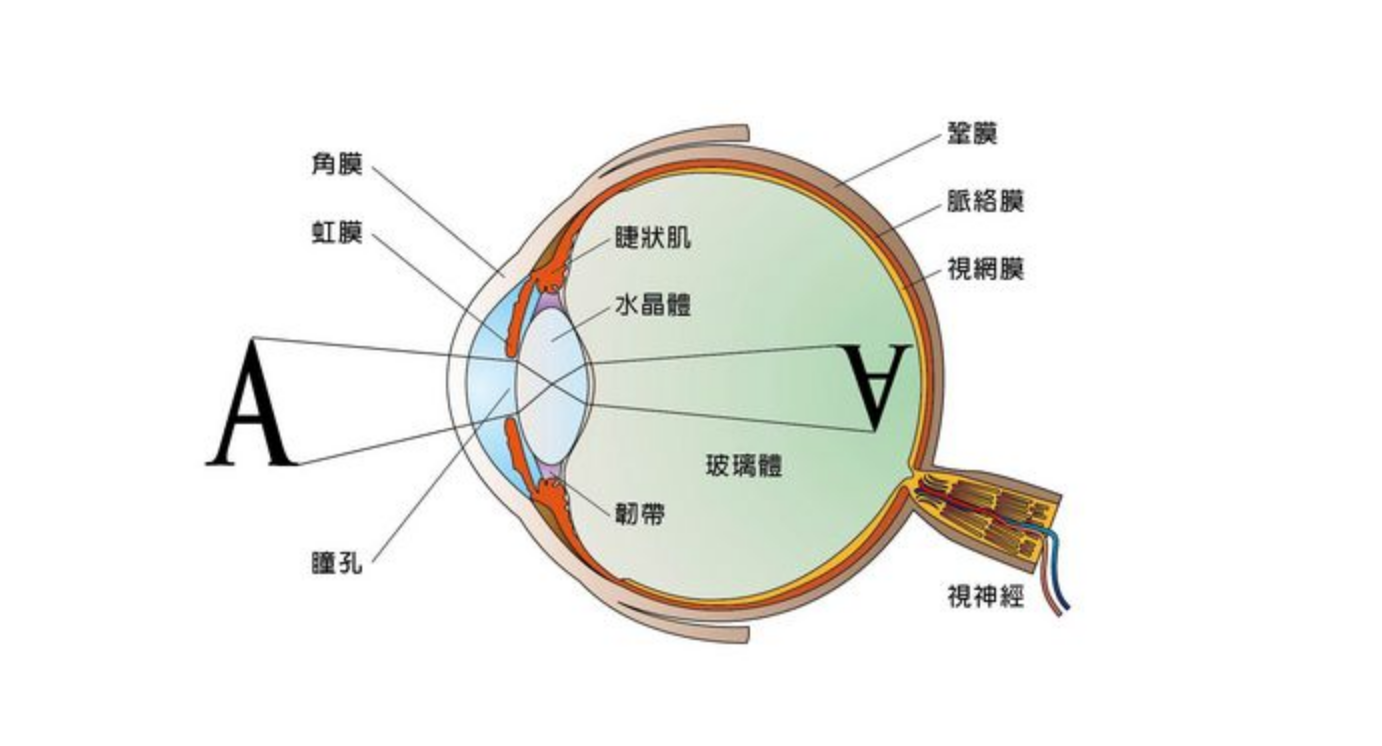 手术治疗近视眼的原理_MCT技术控制近视 非手术治疗近视的首选(2)